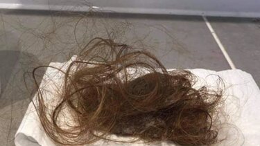 «Αυτό αντίκρισα όταν πήγα να χτενιστώ» - Μαρτυρίες ανθρώπων με long Covid