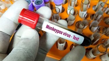 Η ευλογιά των πιθήκων μεταδίδεται ευρέως προσυμπτωματικά