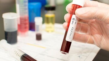 Ισπανία: Εντοπίστηκε το πρώτο μεταδιδόμενο κρούσμα χολέρας από το 1979