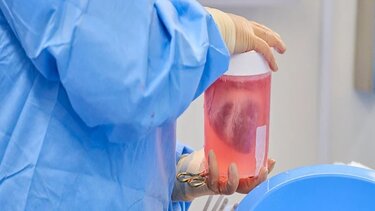 Δύο ακόμη γενετικά τροποποιημένες καρδιές χοίρων μεταμοσχεύθηκαν επιτυχώς σε ανθρώπους