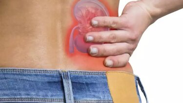 Πώς μπορούμε να προλάβουμε τη δημιουργία λίθων στους νεφρούς