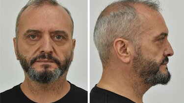 Κολωνός: «Υπάρχουν ενδείξεις εμπλοκής και άλλων προσώπων» λέει ο δικηγόρος των δυο κατηγορουμένων