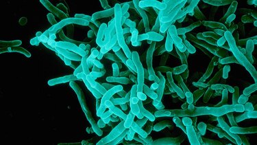 Ελληνική πρωτιά στις ανθεκτικές λοιμώξεις