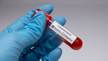 19 θετικά rapid test, χθες, στην Κρήτη