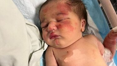 Συγκλονιστική ιστορία στον Λίβανο: Αδέσποτος σκύλος βρήκε στα σκουπίδια μωρό και το έσωσε