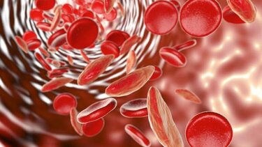 Κατακόρυφη αύξηση των περιστατικών αναιμίας τα τελευταία 30 χρόνια - Τι δείχνει επιστημονική έρευνα