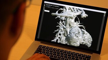 Αυξητική τάση παρουσιάζει η καρδιακή ανεπάρκεια στην τρίτη ηλικία