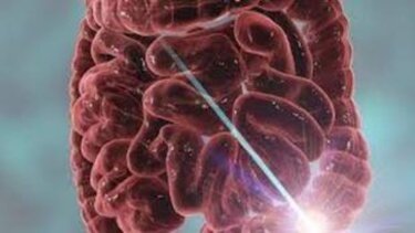 Γυναίκες και ορθοκολικός καρκίνος: Η διατροφή που τις προστατεύει