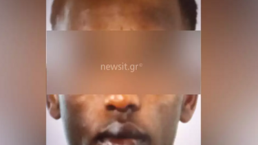 Εξάρχεια: Εφιαλτικές στιγμές για 36χρονη από δύο Σομαλούς - Ήθελαν να της ξεριζώσουν τα δόντια