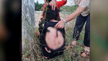 Άγρια επίθεση αγέλης σκύλων σε γυναίκα - "Ήταν σαν να ήμουν η τροφή τους"