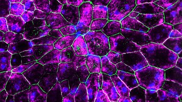 Επαναστατική θεραπεία για την καταπολέμηση της απώλειας όρασης που σχετίζεται με την ηλικία 