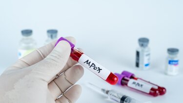Νόσος mpox: Ποιοι κινδυνεύουν περισσότερο από το νέο, επιθετικό στέλεχος
