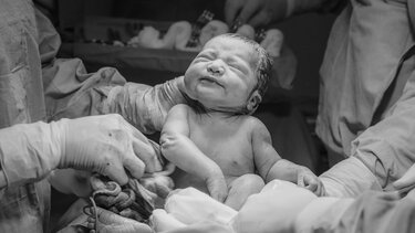 Τοκετός μωρό