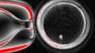 Ανθρώπινο ωάριο που δημιουργήθηκε μέσω μεταφοράς πυρήνα σωματικού κυττάρου