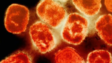 Ευλογιά Πιθήκων, Ιός