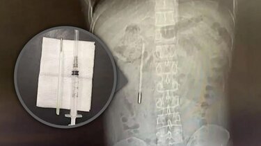 θερμόμετρο