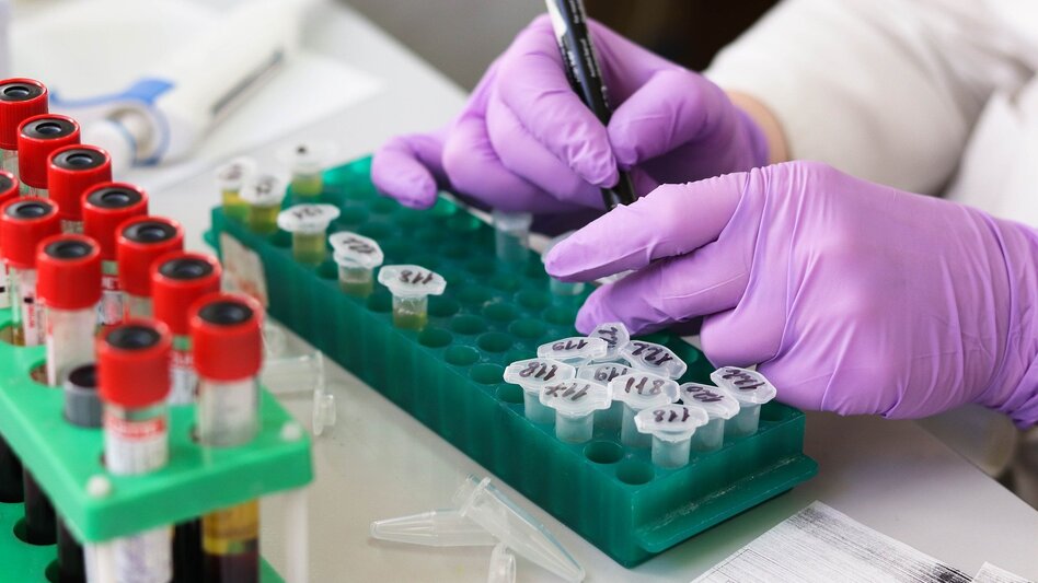 Rapid tests: Τι έδειξαν οι δειγματοληψίες της Τρίτης