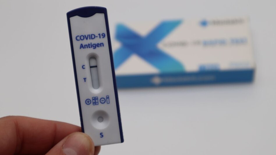 ΕΟΔΥ: Τι έδειξαν τα rapid tests της Παρασκευής