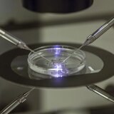 Εκατοντάδες παιδιά γεννήθηκαν από σπέρμα δότη με καρκινικό γονίδιο - Χρησιμοποιήθηκε και στην Ελλάδα