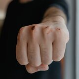 Ξυλοκόπησαν εργαζόμενους στην Καθαριότητα του Δήμου Ηρακλείου - Στα δικαστήρια η υπόθεση - Βίντεο