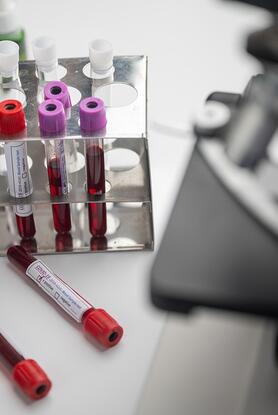 Μια απλή εξέταση αίματος ανιχνεύει καρκίνους κι άλλες ασθένειες