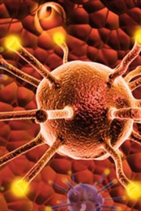 Καρκίνος εντέρου: 1 στους 2 δεν γνωρίζουν ποια τρόφιμα αυξάνουν τον κίνδυνο