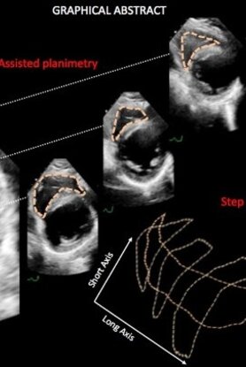 Λογισμικό Ελλήνων επιστημόνων ανιχνεύει καρδιακά προβλήματα 